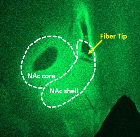 NAc Shell Core Fiber Tip